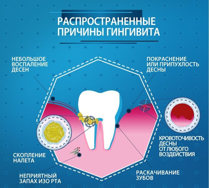 gum disease