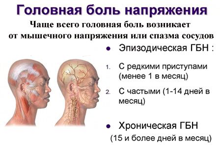 Headache - types, treatment, how to relieve pain?