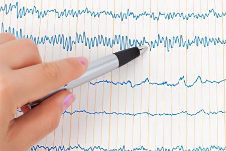 Heart bradycardia: what is it? Symptoms and treatment