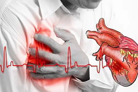 Heart palpitations: what to do? Main reasons