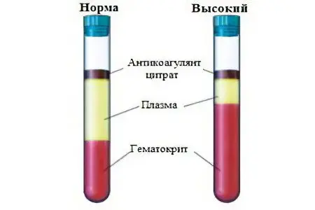 Hematocrit: what is its norm and what does it mean?