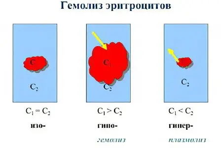 Hemolysis &#8211; what is it?