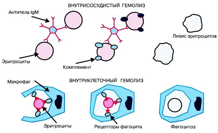 Hemolysis - what is it?