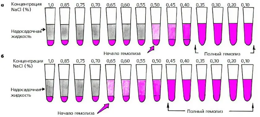 Hemolysis - what is it?