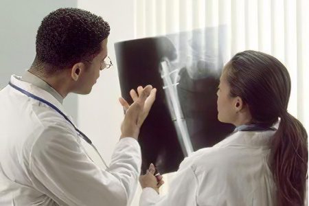 Hip fracture