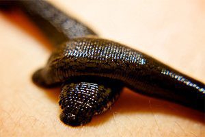 Hirudotherapy - treatment with leeches at home