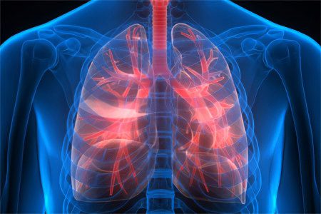 How is pneumonia different from other lung diseases?