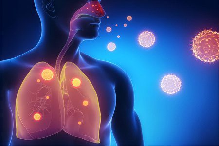 How is pneumonia different from other lung diseases?