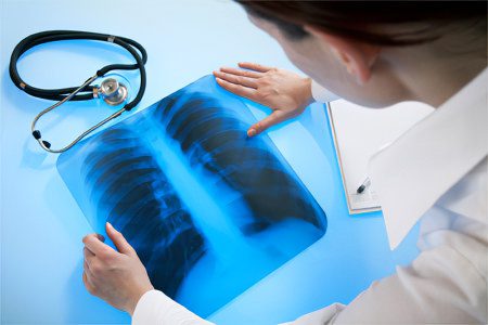 How is pneumonia different from other lung diseases?