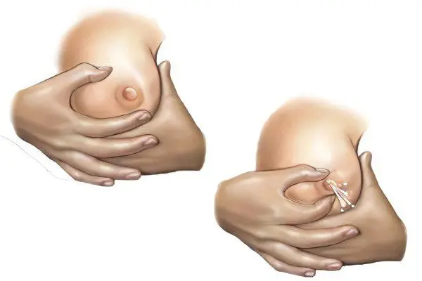 How to express breast milk with your hands, how much and how to store expressed breast milk?