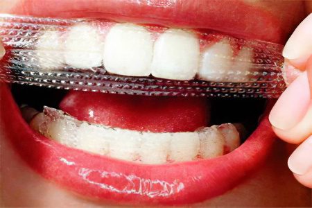 How to whiten teeth enamel at home?