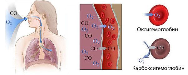 Hypercapnia and hypoxemia - consequences and treatment