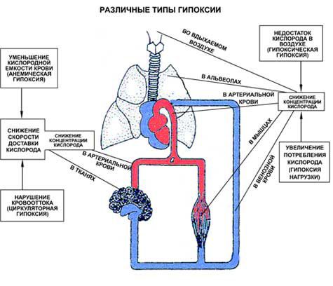 Hypercapnia and hypoxemia - consequences and treatment