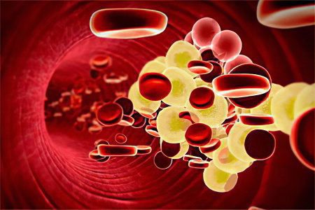 Hypercholesterolemia: Symptoms and Treatments