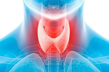 Hyperthyroidism in women and men