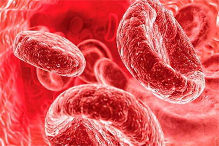 hypochromic anemia