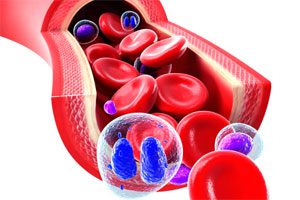 Hypoproteinemia