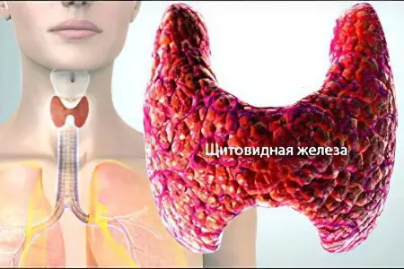 Hypothyroidism in women