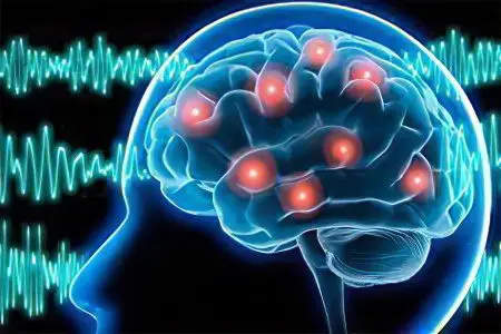 Hypoxia of the brain