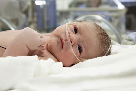 Hypoxic-ischemic lesion of the central nervous system in newborns