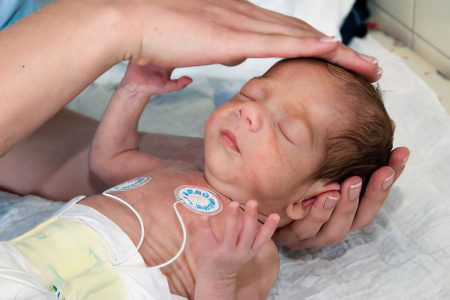 Hypoxic-ischemic lesion of the central nervous system in newborns