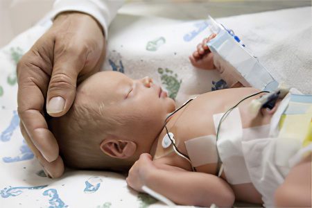 Hypoxic-ischemic lesion of the central nervous system in newborns