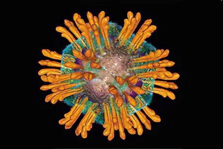 infectious hepatitis