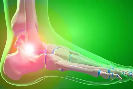 Inflammation of the joints &#8211; diseases, as a cause, symptoms and treatment