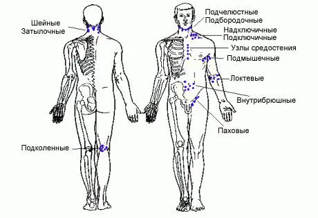 Inflammation of the lymph nodes in the neck: what are the causes?