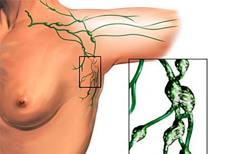 Inflammation of the lymph nodes in the neck: what are the causes?