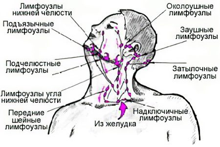 Inflammation of the lymph nodes in the neck: what are the causes?