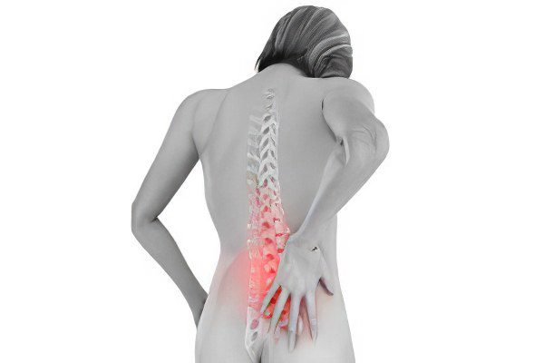 Intervertebral hernia: symptoms and treatment