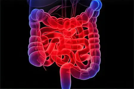 Intestinal infection: the first symptoms and treatment