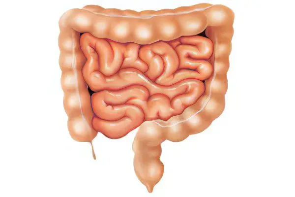 Intestinal paresis