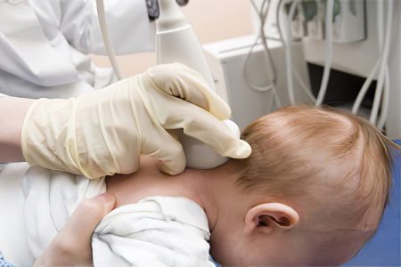 Intracranial pressure in newborns