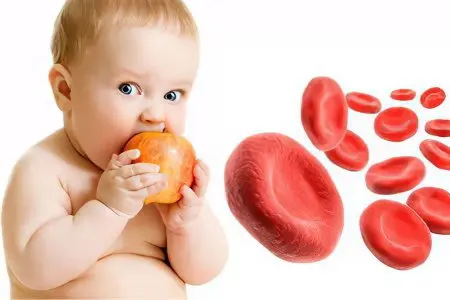 Iron deficiency anemia in children