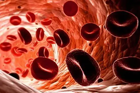 Iron deficiency anemia in children