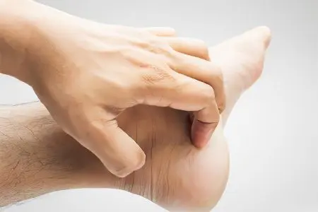 Itchy feet: what to do?