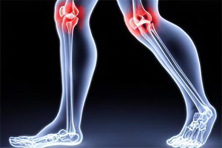 Joint diseases: types, symptoms and treatment