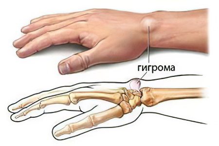 Joint diseases: types, symptoms and treatment