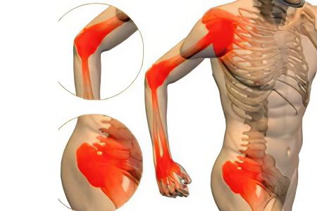 Joint diseases: types, symptoms and treatment