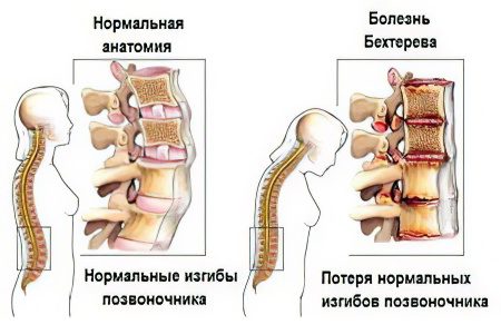 Joint diseases: types, symptoms and treatment