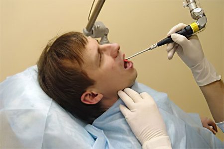 Laser snoring treatment