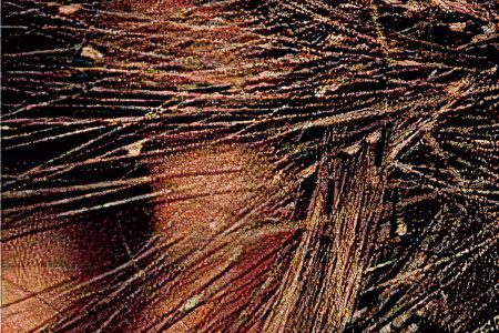 Lice on the head &#8211; what do lice look like? How to get rid of them?