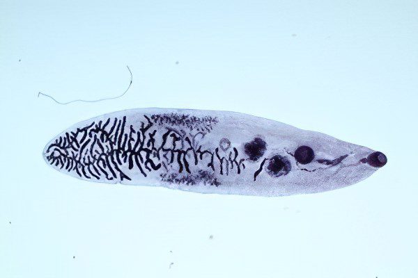 Life cycle of the liver fluke