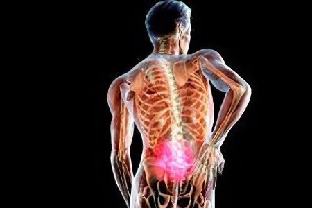 Lower back pain when walking