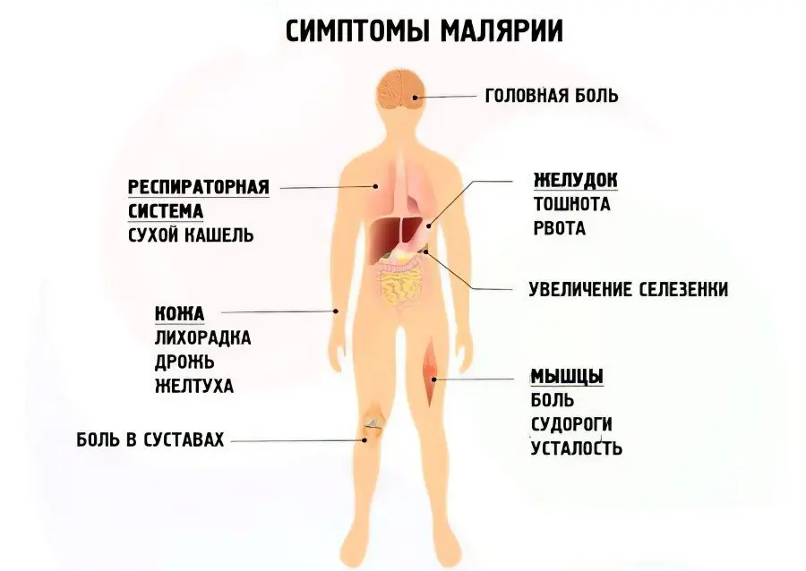 Malaria: first symptoms and treatment