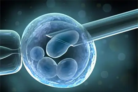 Male infertility