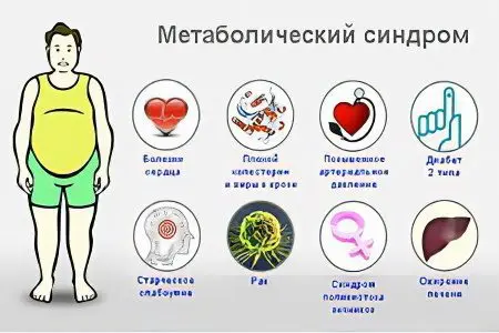 Metabolic syndrome: sanhi, sintomas at paggamot