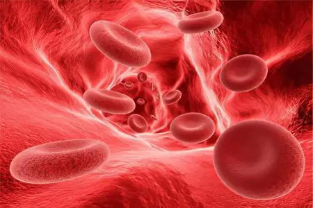 Mild, moderate and severe anemia